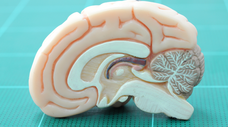 A side view image of a brain